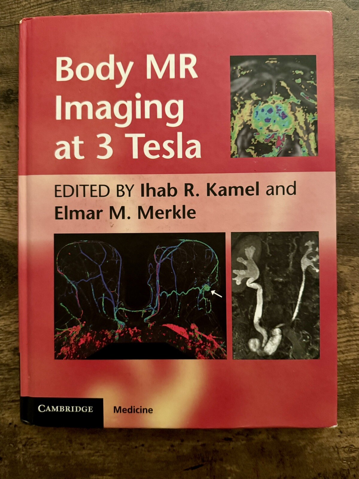 BODY MR IMAGING AT 3 TESLA (CAMBRIDGE MEDICINE By Ihab R. Kamel & Elmar M. VG