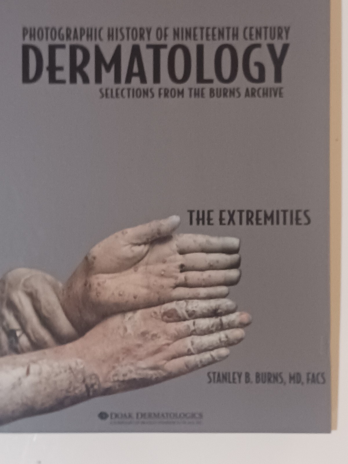 Photographic History of Nineteenth Century Dermatology by Stanley Burns Box Set