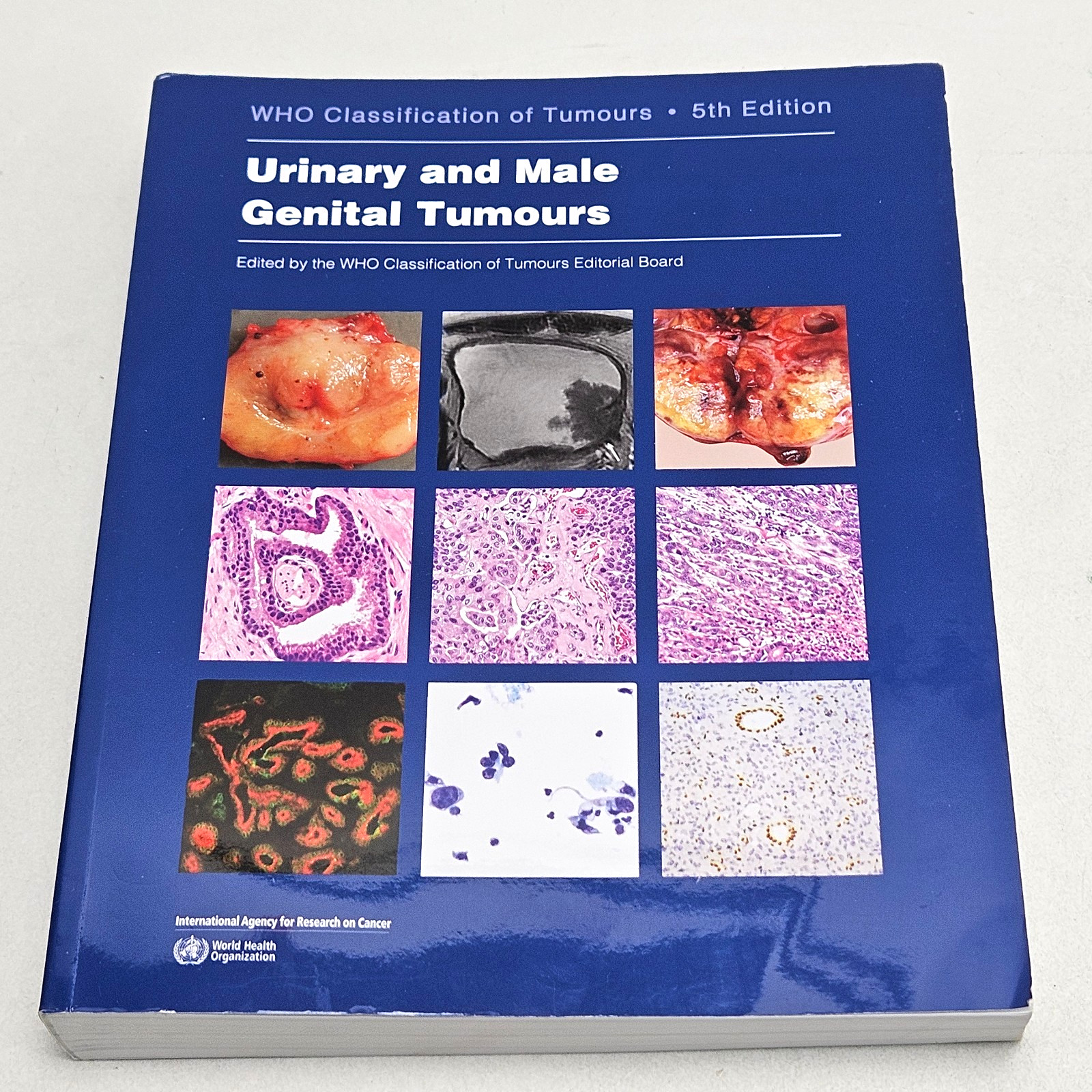 WHO Classification of Tumours 5th Ed. Urinary and Male Genital Tumours Paperback