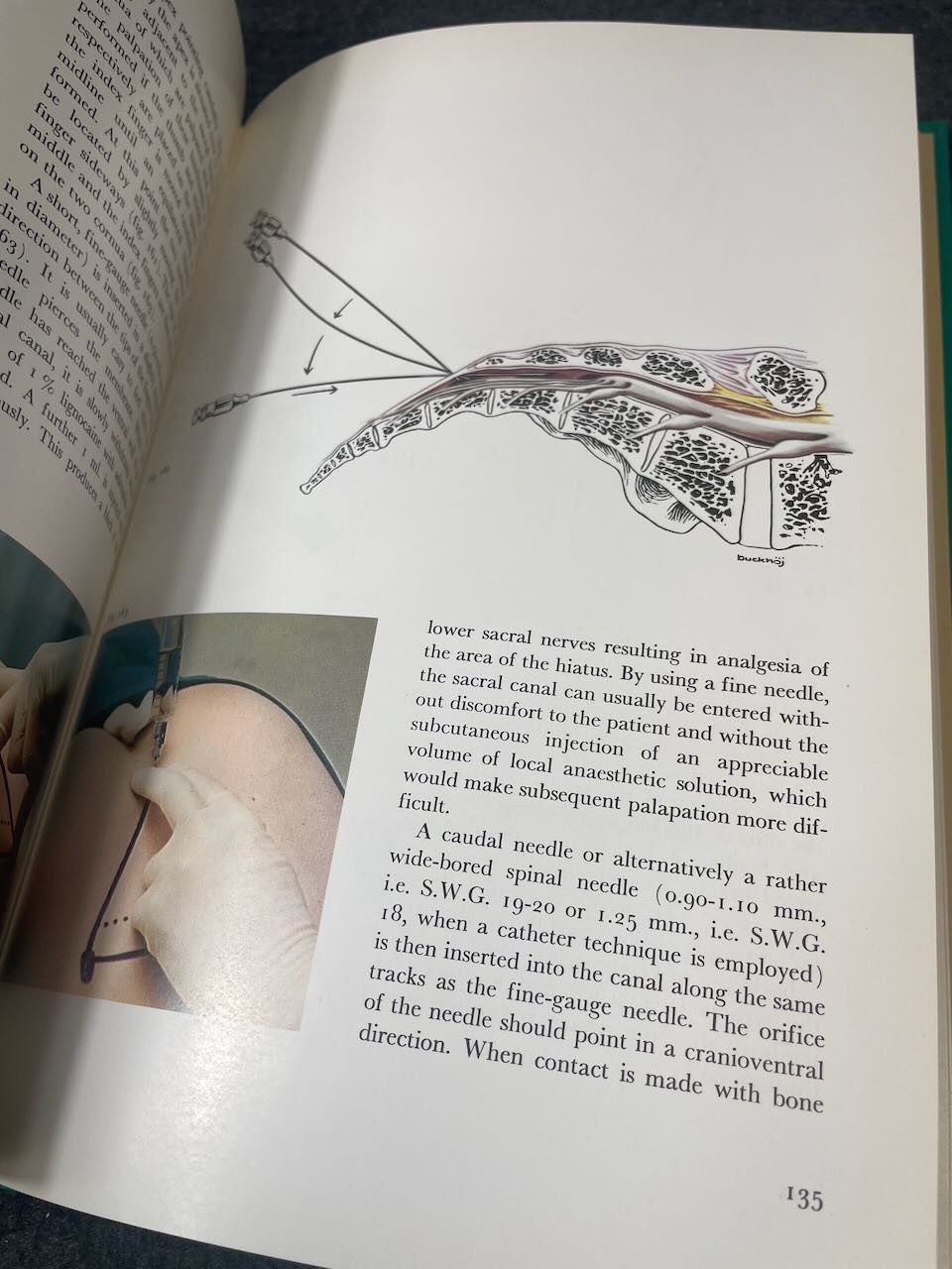 Illustrated Handbook in Local Anaesthesia 2nd Ed Ejnar Eriksson Hardcover Book