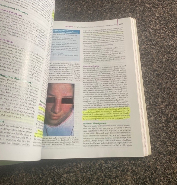 Introductory Medicalsurgical Nursing – Paperback By Timby, Barbara Kuhn – GOOD