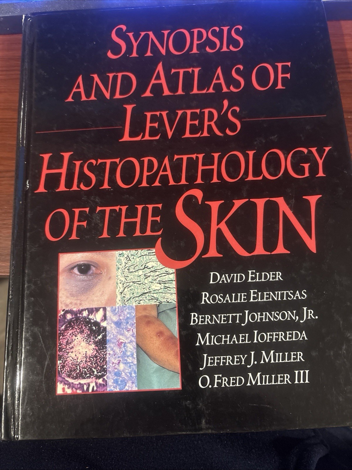 Synopsis and Atlas of Lever’s Histopathology of the Skin by Michael Ioffreda,…