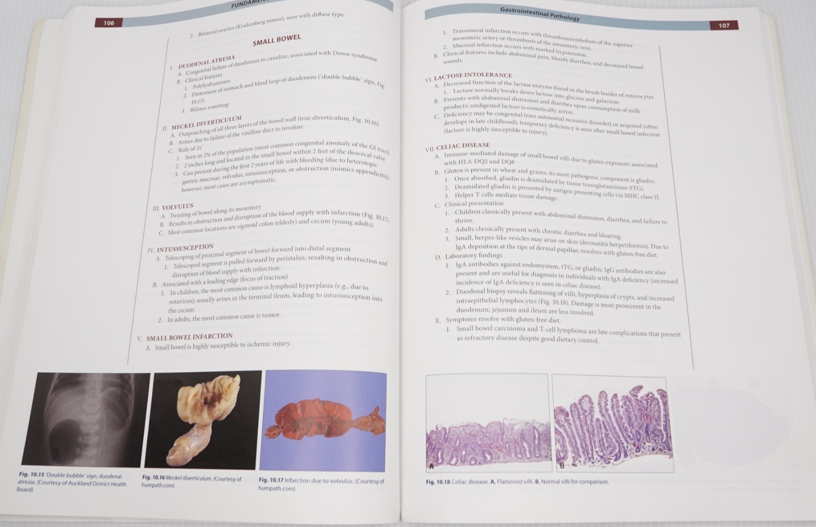 Fundamentals of Pathology by Husain A. Sattar First Edition Softcover Textbook