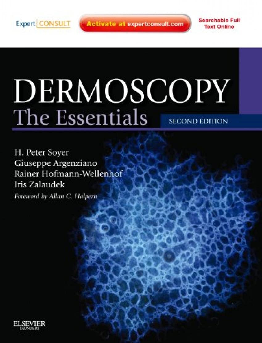 Dermoscopy: The Essentials: Expert Consult – Online and Print