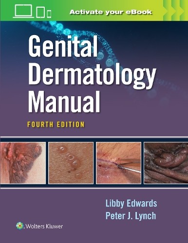 Peter Lynch Elizabeth Edwards Genital Dermatology Manual (Paperback)