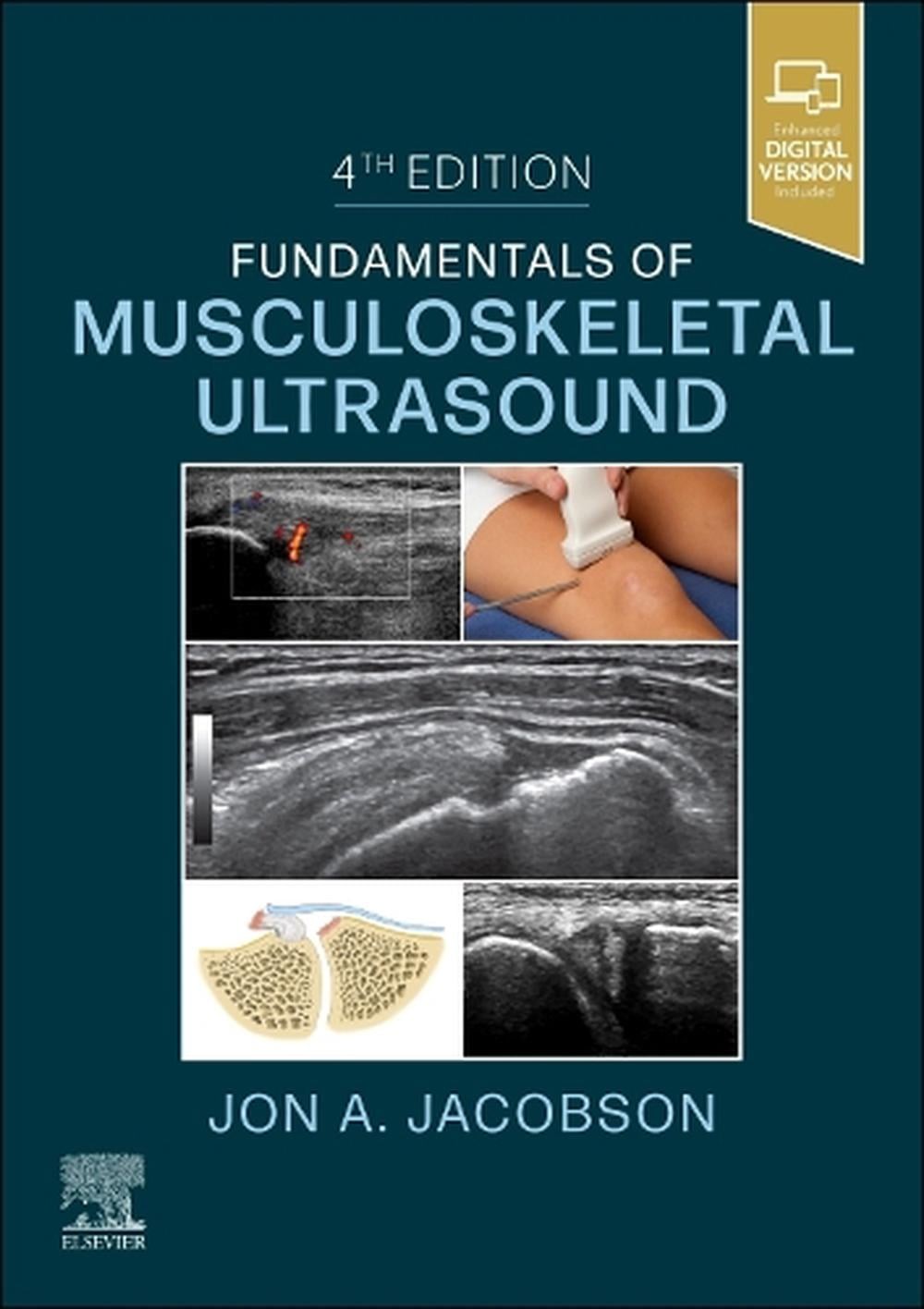 Fundamentals of Musculoskeletal Ultrasound by Jon A. Jacobson Paperback Book