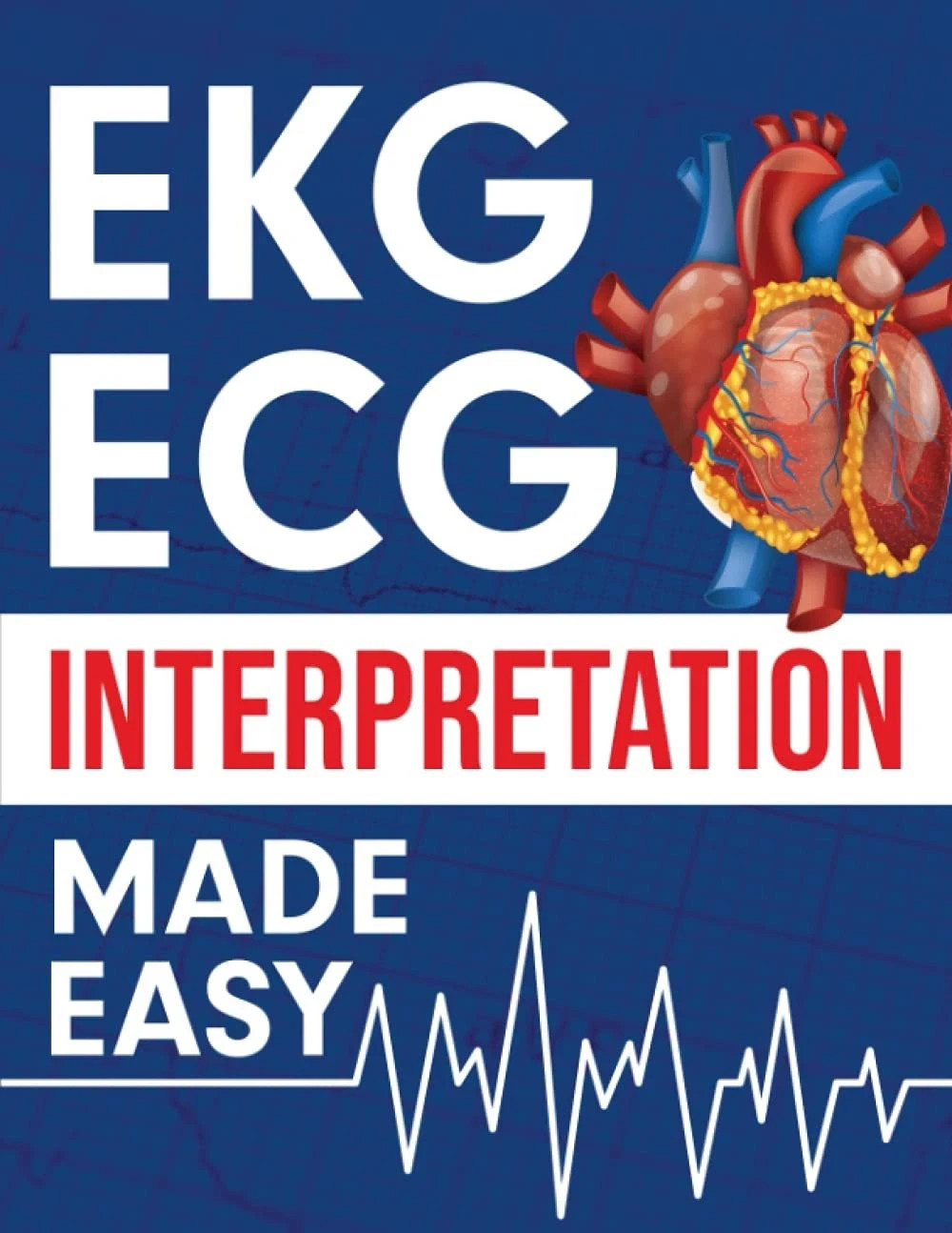 EKG ECG Interpretation Made Easy: An Illustrated Study Guide for Students